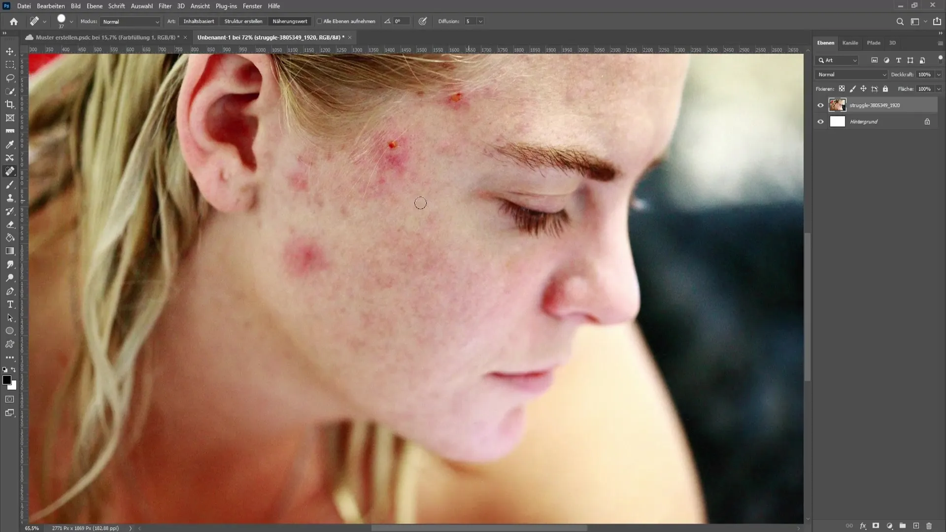 Removing blemishes and pimples in Photoshop - The comprehensive tutorial