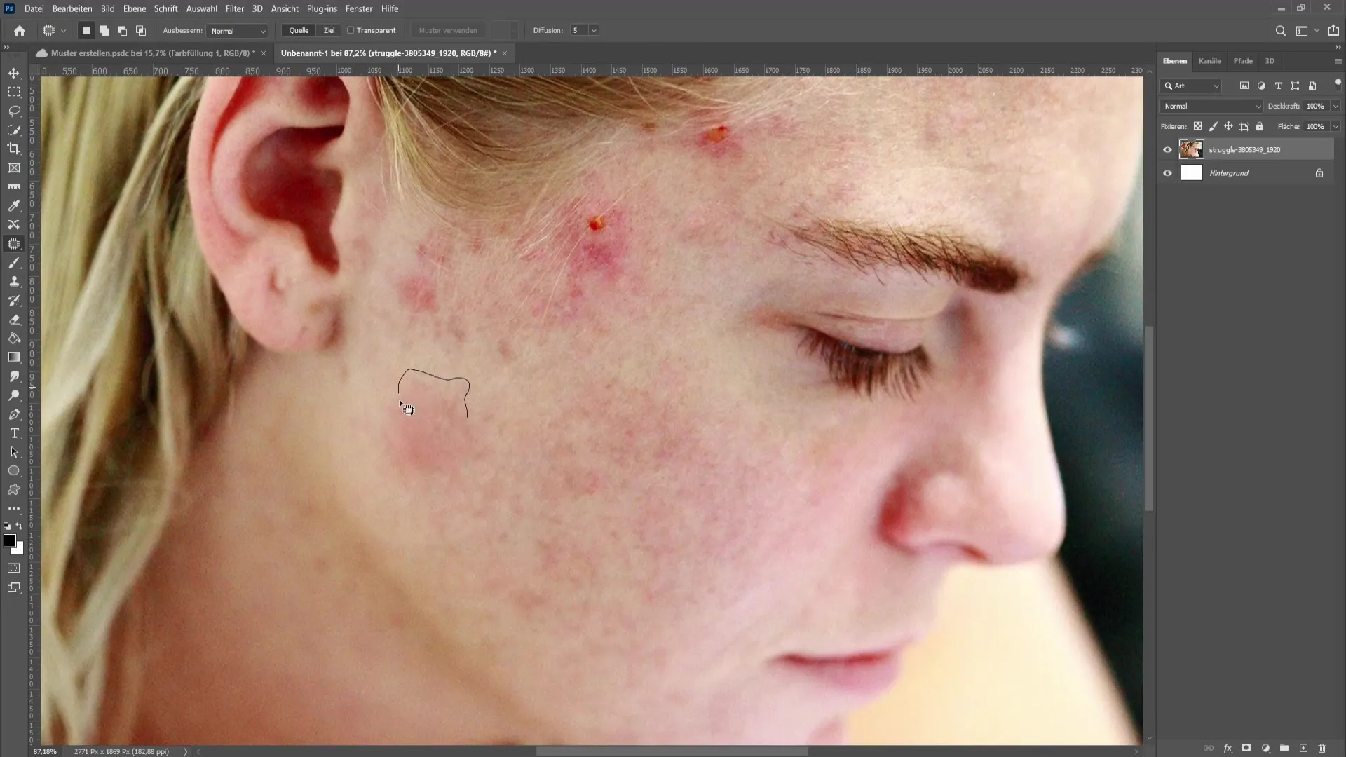 Removing blemishes and pimples in Photoshop - The comprehensive tutorial