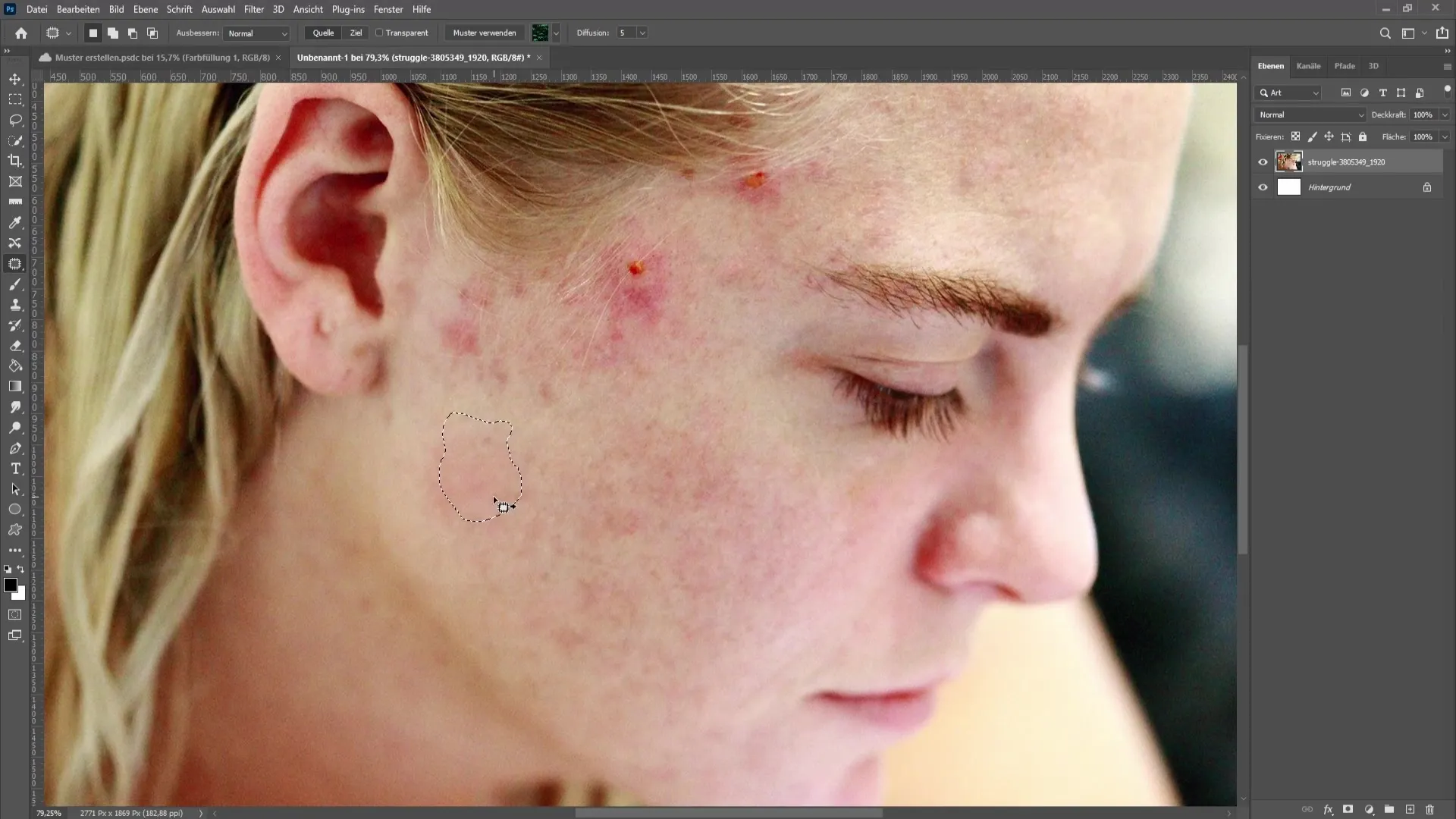 Remove skin imperfections and pimples in Photoshop - The comprehensive tutorial