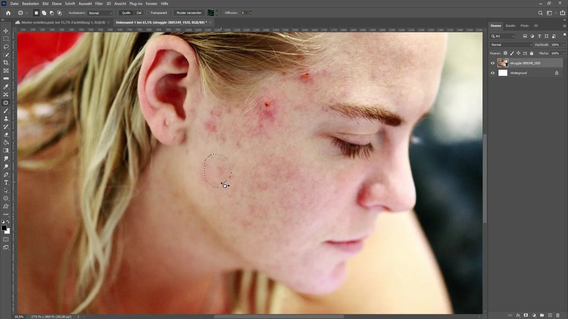 Remove skin impurities and pimples in Photoshop - The comprehensive tutorial