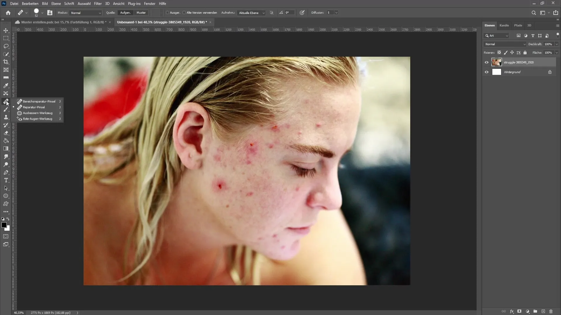 Removing skin impurities and pimples in Photoshop - The comprehensive tutorial