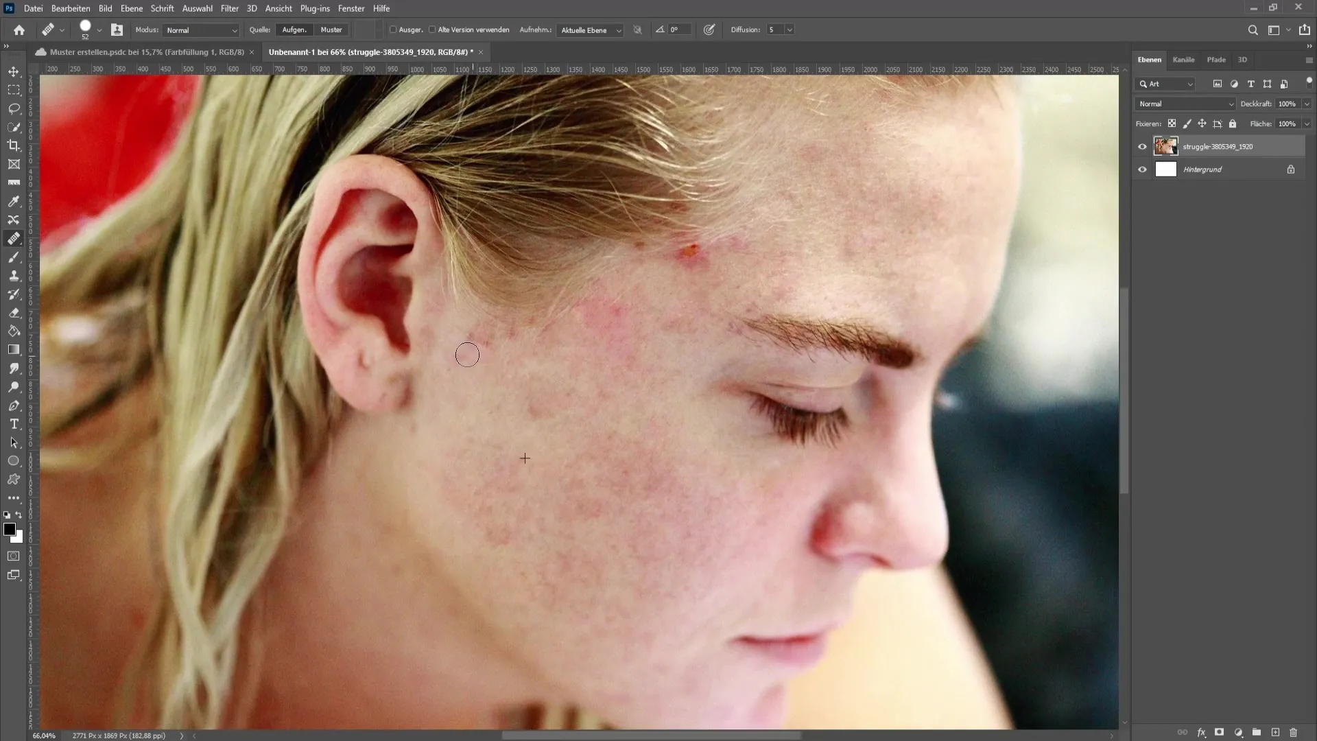 Remove skin impurities and pimples in Photoshop - The comprehensive tutorial