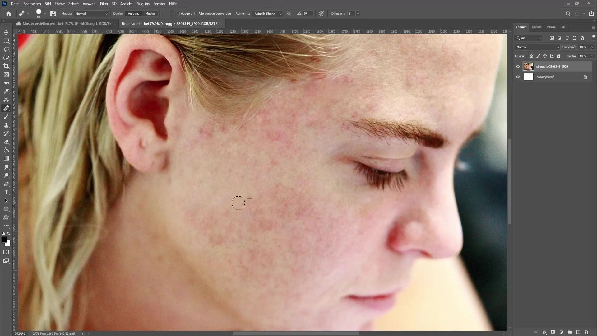 Remove skin impurities and pimples in Photoshop - The comprehensive tutorial