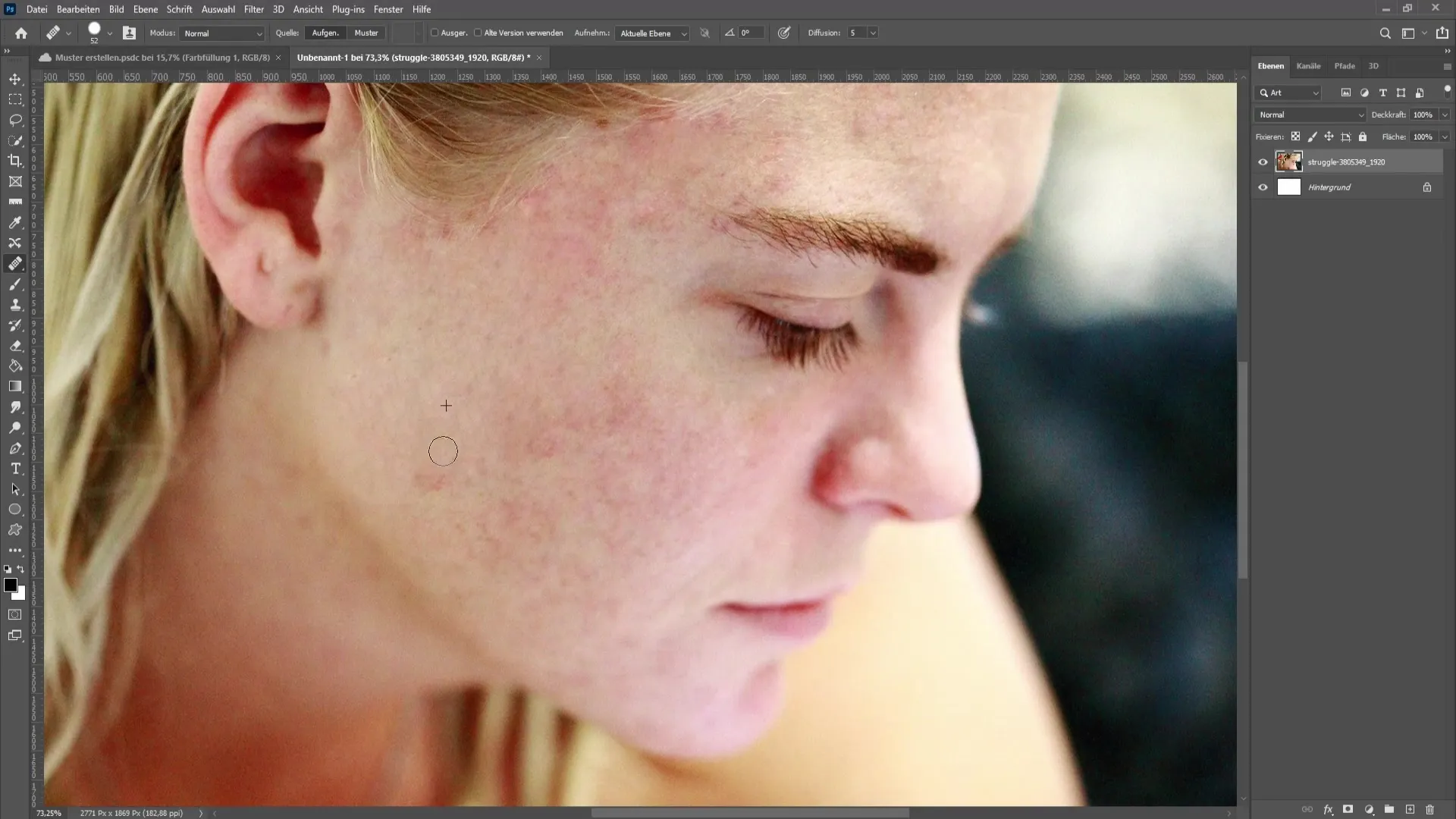 Remove skin impurities and pimples in Photoshop - The comprehensive tutorial