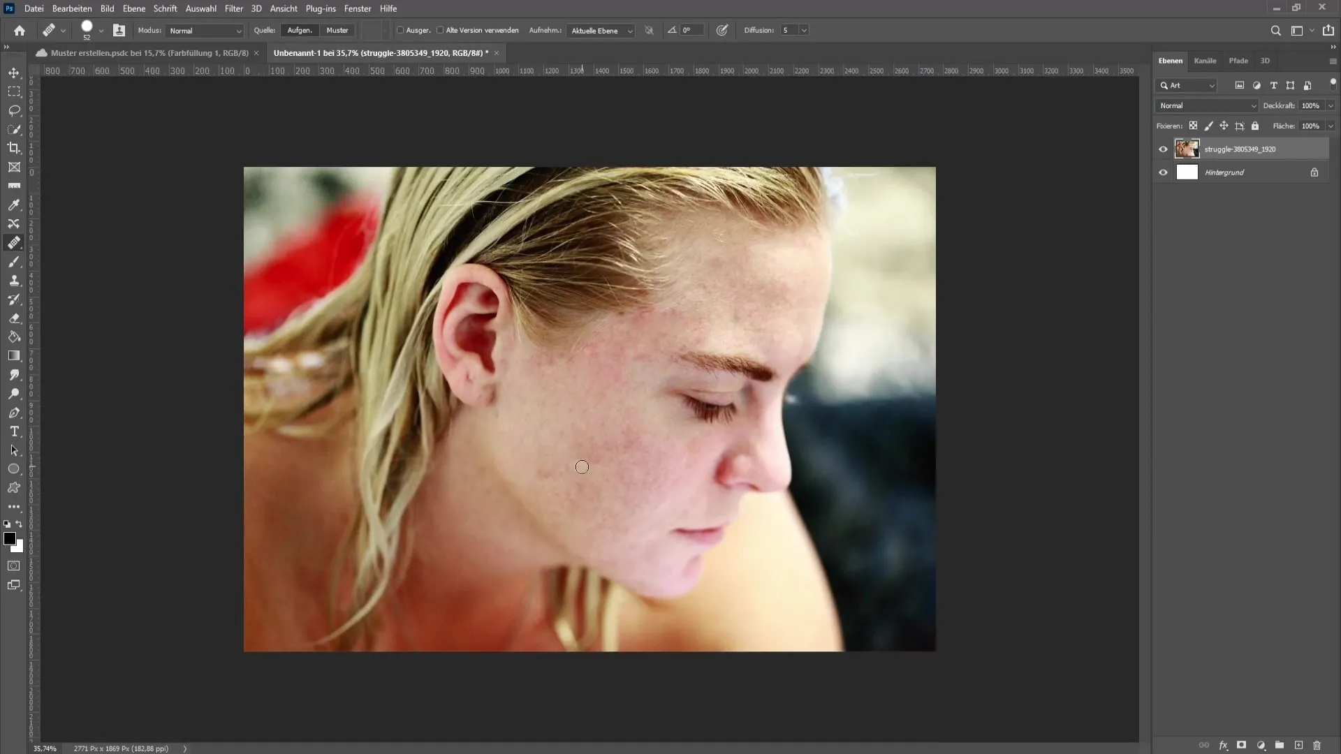 Removing blemishes and pimples in Photoshop - The comprehensive tutorial