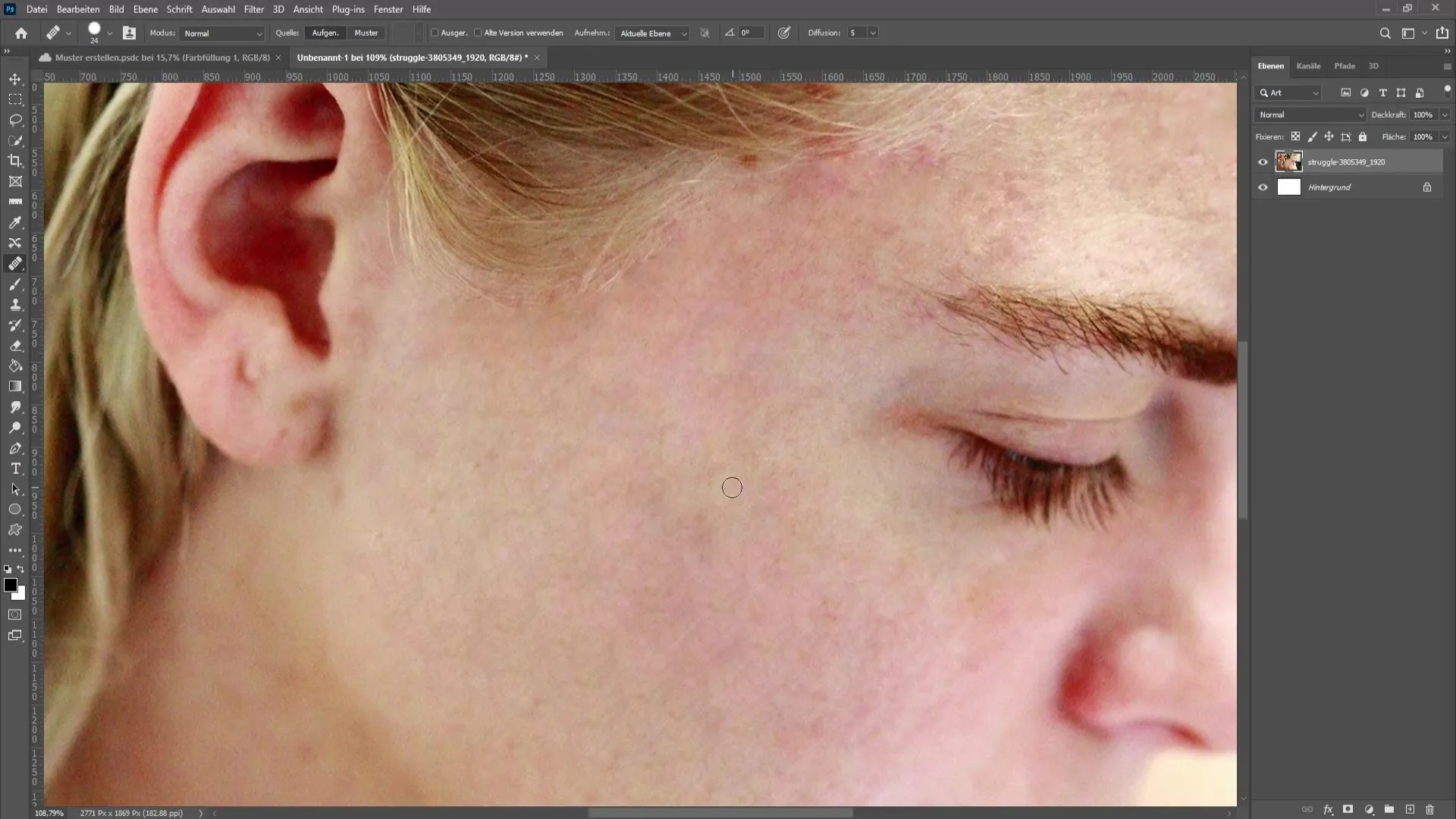 Remove skin impurities and pimples in Photoshop - The comprehensive tutorial