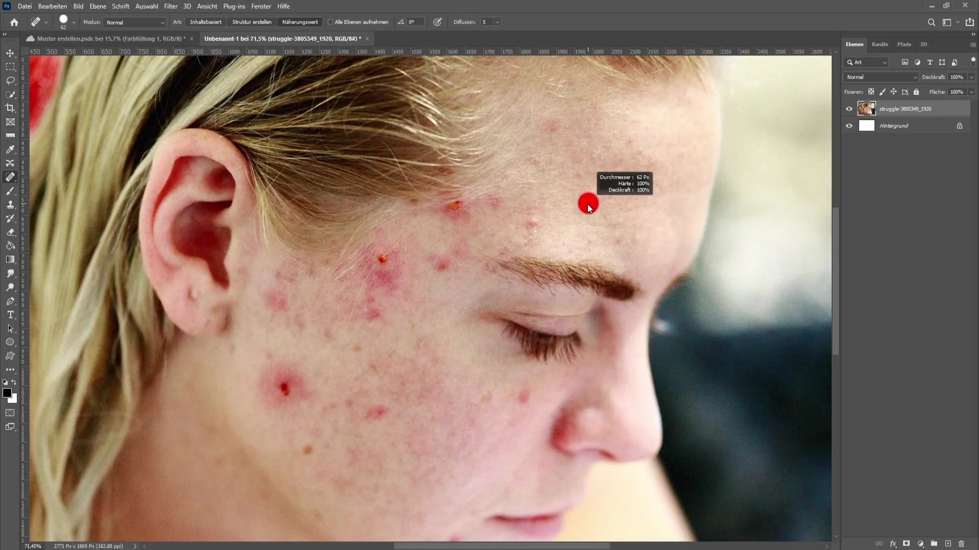 Remover imperfeições de pele e acne no Photoshop - O tutorial abrangente