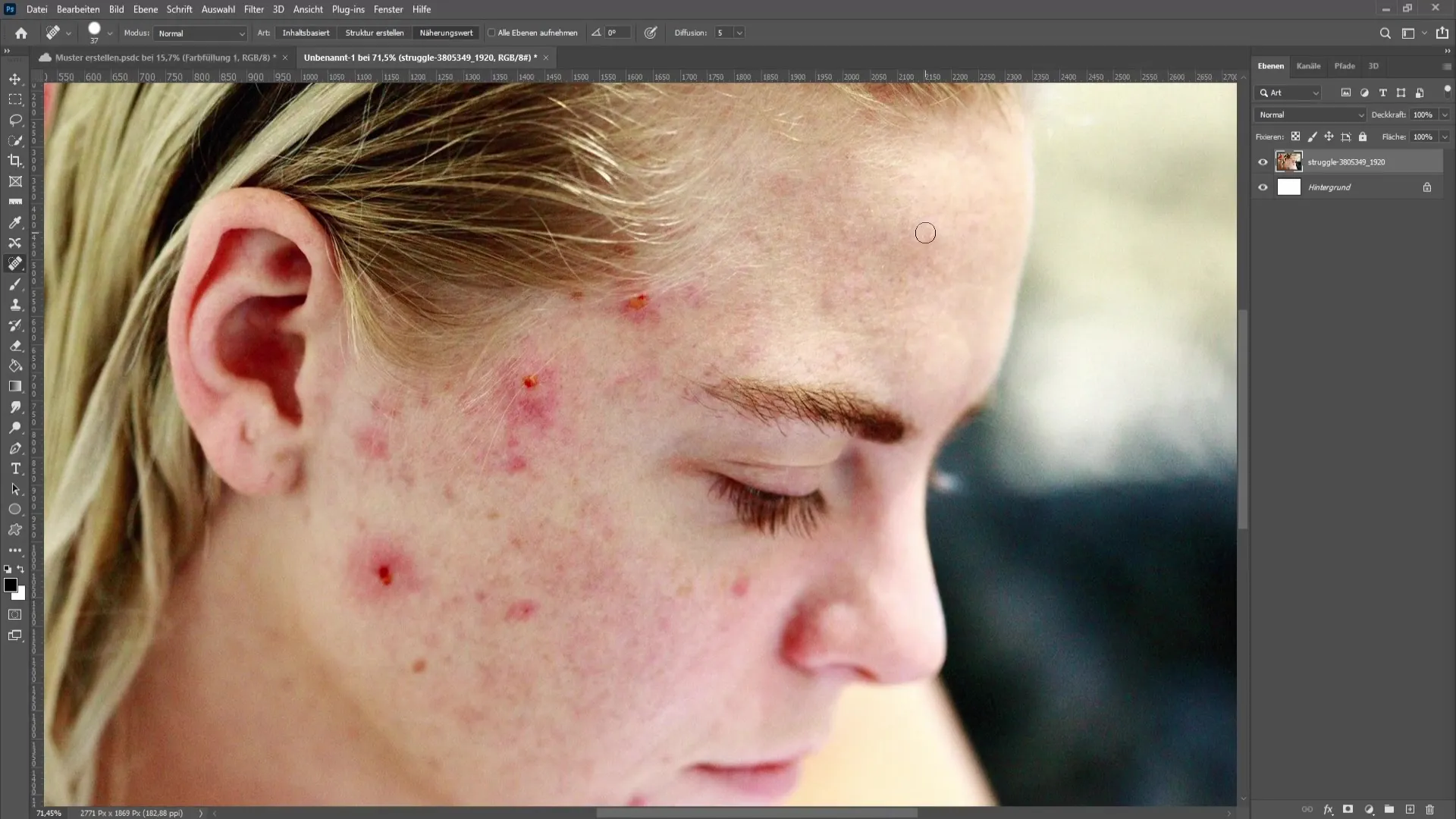 Removing skin imperfections and pimples in Photoshop - The comprehensive tutorial