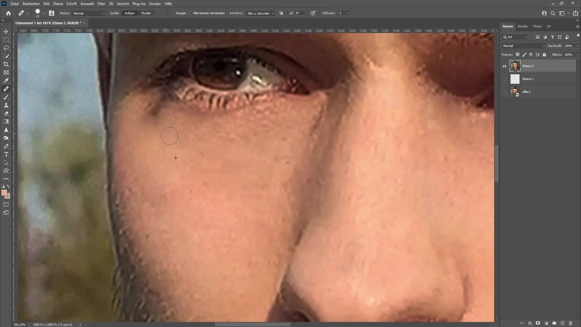 Remove dark circles with Photoshop - A step-by-step guide